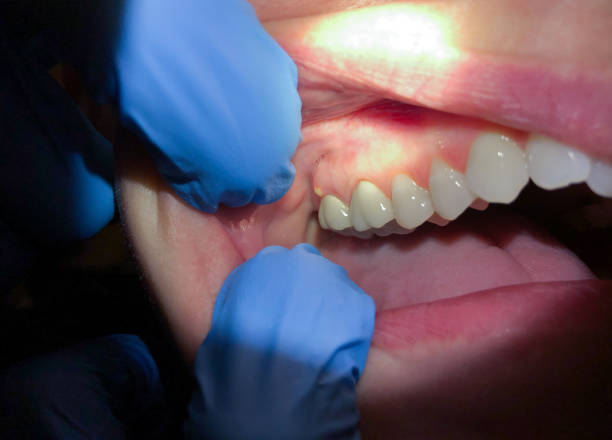 Best Emergency Tooth Extraction  in Jefferson City, MO