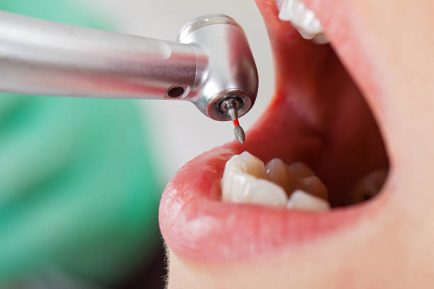 Emergency Gum Pain Relief in MO
